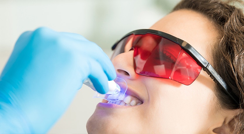 Teeth Whitening