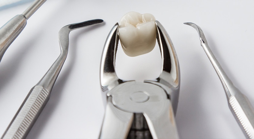 Wisdom Teeth Extraction