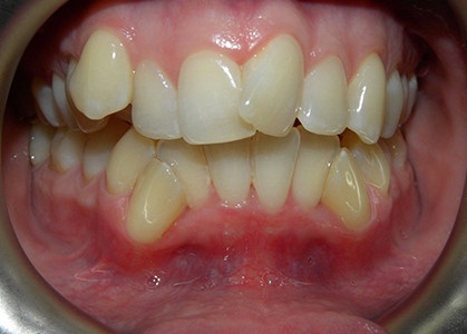 Before