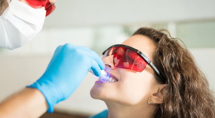 Exploring the Role of Fluoride in Preventing Tooth Decay
